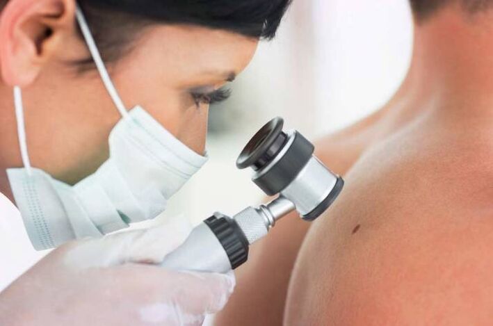 Doctors examine papilloma