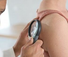 How to determine a human papilloma virus