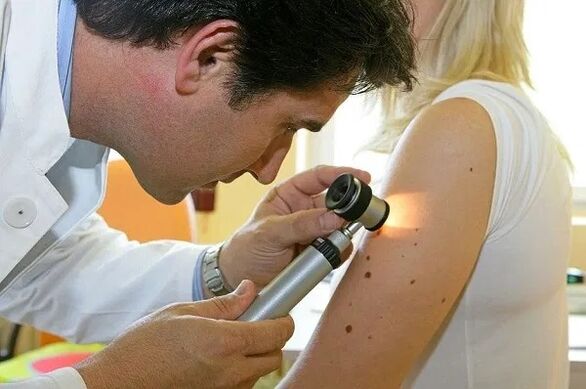 diagnosis of papilloma
