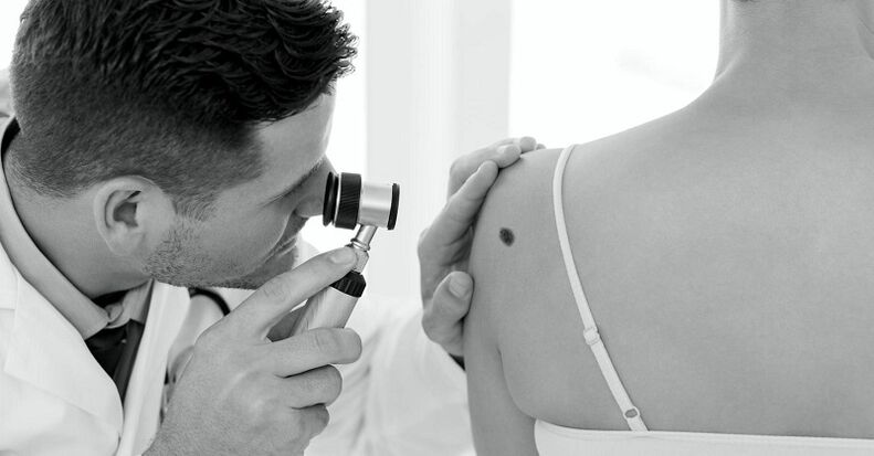 specialist diagnoses the type of warts